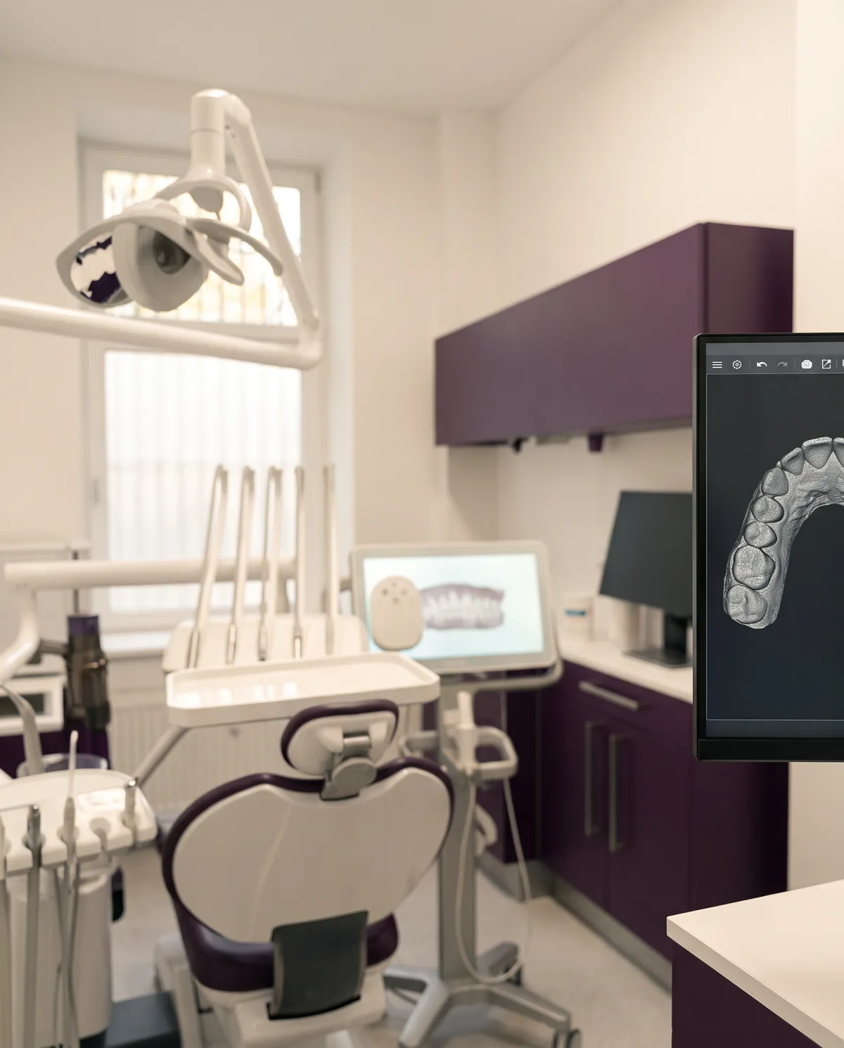 Monitor mit digitalem Wax-up einer 3D-Scan-Planung — Symbolbild